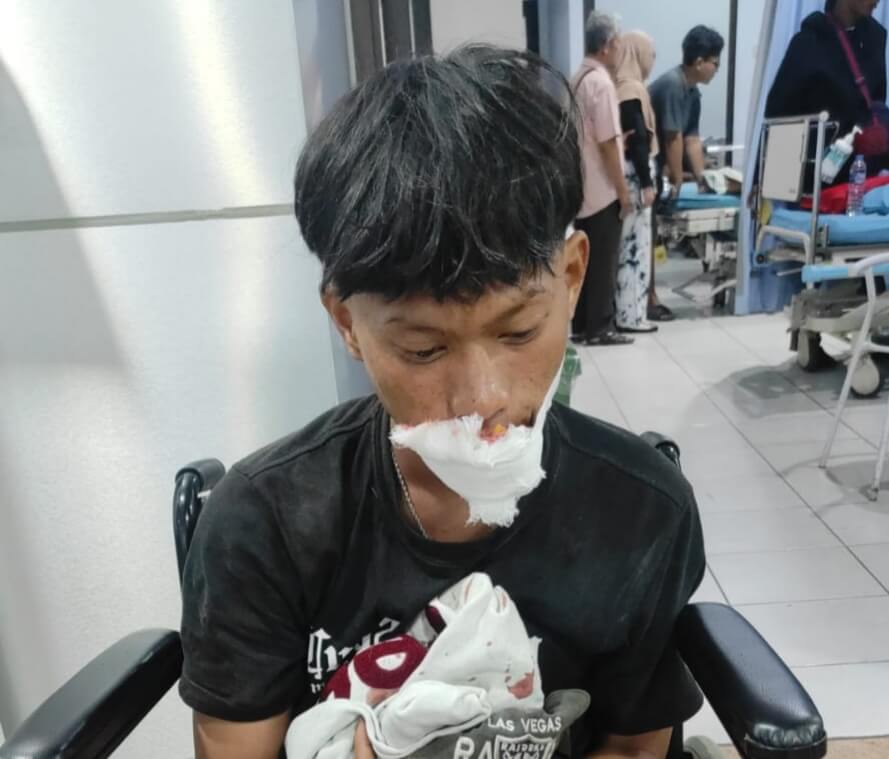 LBH Pijar Catat Sebanyak 25 Demonstran di Kota Serang Alami Luka-luka